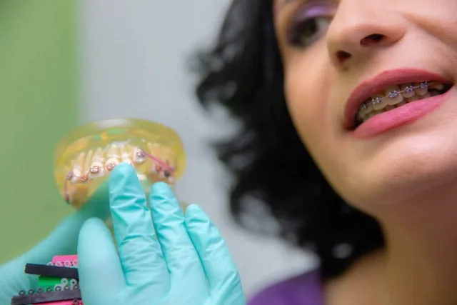 Servicii stomatologice complete - aparat dentar, implanturi, albire dentară București – fotografia 4 din 5